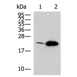 HRAS rabbit polyclonal antibody