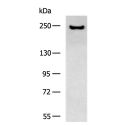 ACACA rabbit polyclonal antibody