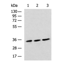 OPRM1 rabbit polyclonal antibody