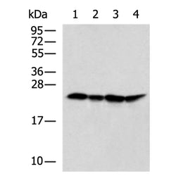 RPS9 rabbit polyclonal antibody