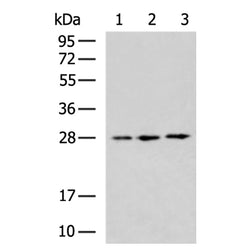 DNAJB8 rabbit polyclonal antibody