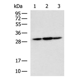 SBDS rabbit polyclonal antibody