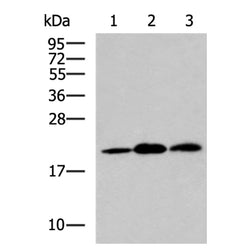 ARPC4 rabbit polyclonal antibody