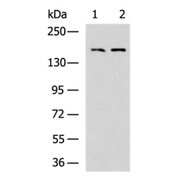 PDGFRB rabbit polyclonal antibody