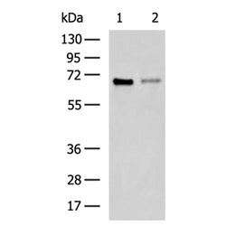 ESR1 rabbit polyclonal antibody