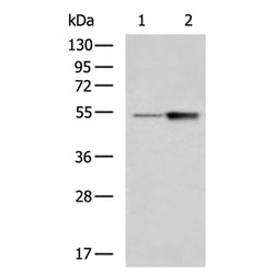 STEAP3 rabbit polyclonal antibody