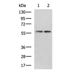 CYP8B1 rabbit polyclonal antibody