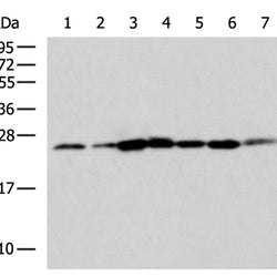 ELOVL5 rabbit polyclonal antibody