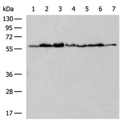 PEX14 rabbit polyclonal antibody