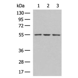 HEXA rabbit polyclonal antibody