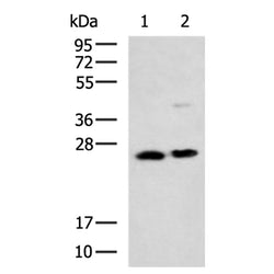 GSTM5 rabbit polyclonal antibody