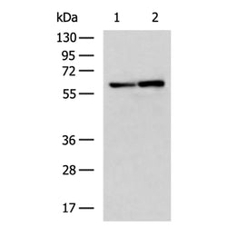 MAOB rabbit polyclonal antibody