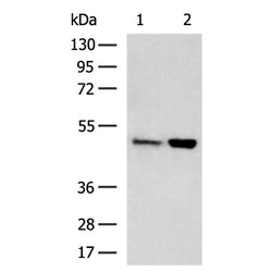 HGD rabbit polyclonal antibody