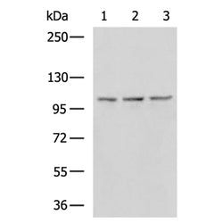 EXOSC10 rabbit polyclonal antibody