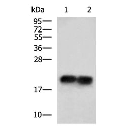 HPCAL4 rabbit polyclonal antibody
