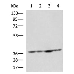 MRPL3 rabbit polyclonal antibody