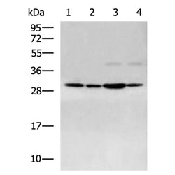 AGPAT2 rabbit polyclonal antibody