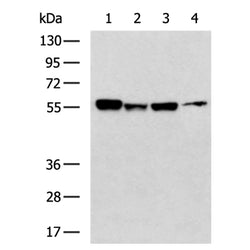EDNRA rabbit polyclonal antibody