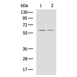 PCCB rabbit polyclonal antibody