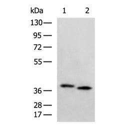 CTSV rabbit polyclonal antibody