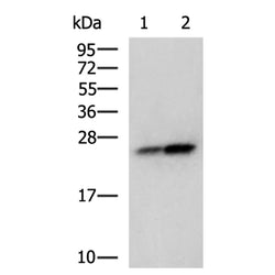 CDKN1B rabbit polyclonal antibody