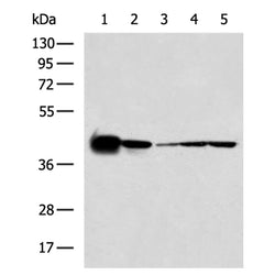MAPK1 rabbit polyclonal antibody