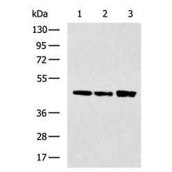 CTSD rabbit polyclonal antibody