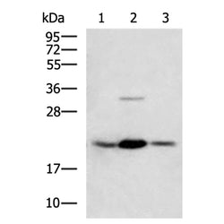 MGMT rabbit polyclonal antibody