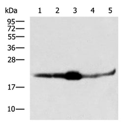 IFNA2 rabbit polyclonal antibody