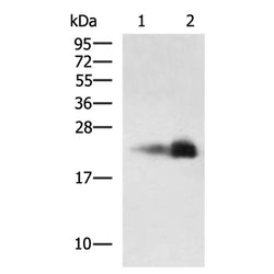 CLDN6 rabbit polyclonal antibody