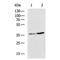 RNF41 rabbit polyclonal antibody