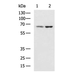 TNFRSF11A rabbit polyclonal antibody
