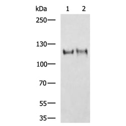 CDH16 rabbit polyclonal antibody