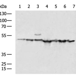 SCRN1 rabbit polyclonal antibody