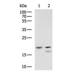 TCEAL1 rabbit polyclonal antibody