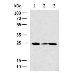 RAB32 rabbit polyclonal antibody