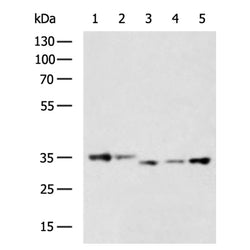 LDHB rabbit polyclonal antibody