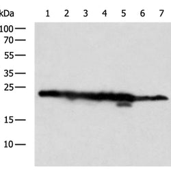 RPL9 rabbit polyclonal antibody
