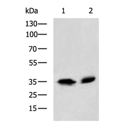 HNRNPA2B1 rabbit polyclonal antibody