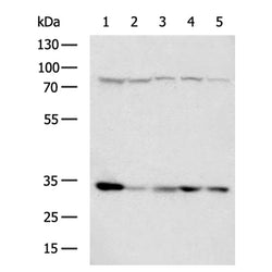 NAT1 rabbit polyclonal antibody
