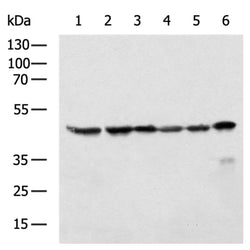 SUCLG2 rabbit polyclonal antibody