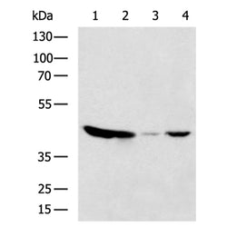 GOT2 rabbit polyclonal antibody