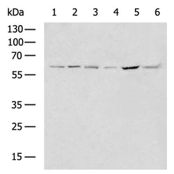CCT7 rabbit polyclonal antibody