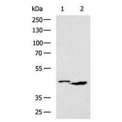 RP2 rabbit polyclonal antibody