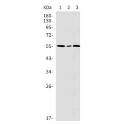 ABAT rabbit monoclonal antibody