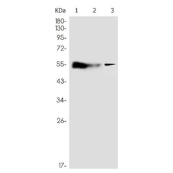 ABHD16A rabbit monoclonal antibody