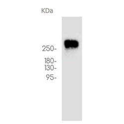 ACACA/ACACB rabbit monoclonal antibody