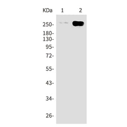 ACACB rabbit monoclonal antibody