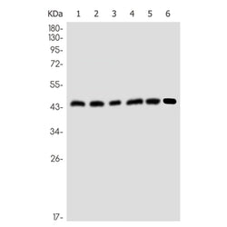 ACADM rabbit monoclonal antibody