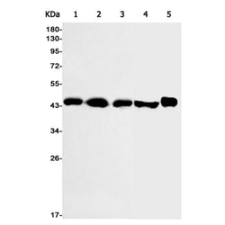 ACADS rabbit monoclonal antibody